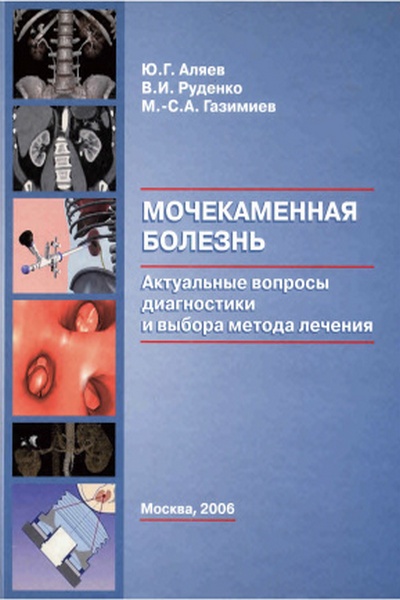 Мочекаменная болезнь. Актуальные вопросы диагностики и выбора метода лечения